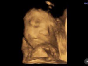 3D Black and White Image of Baby's Developme
