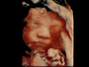 3D Colored Image of Baby's Developme