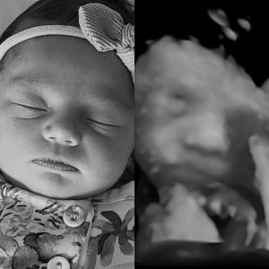 Eva's Picture Before and After Her Birth