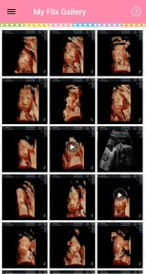 Colored 3D Images of Eva's Pre-Birth Development